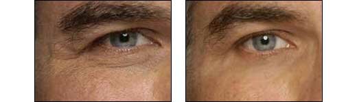 Before and After Photos