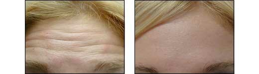 Before and After Photos
