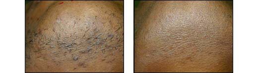 Before and After Photos