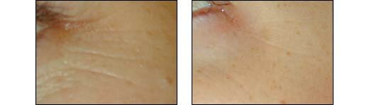 Before and After Photos