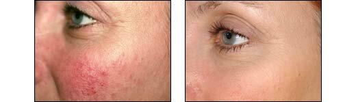 Before and After Photos