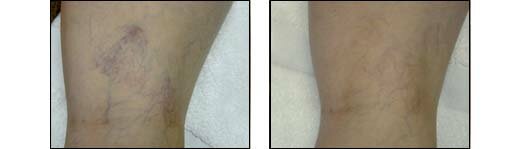 Before and After Photos